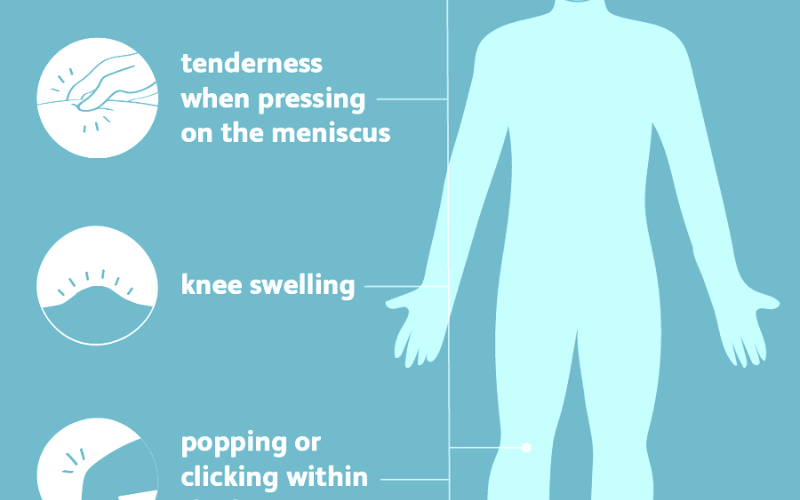 Symptoms of Torn Meniscus